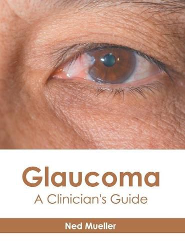 Cover image for Glaucoma: A Clinician's Guide