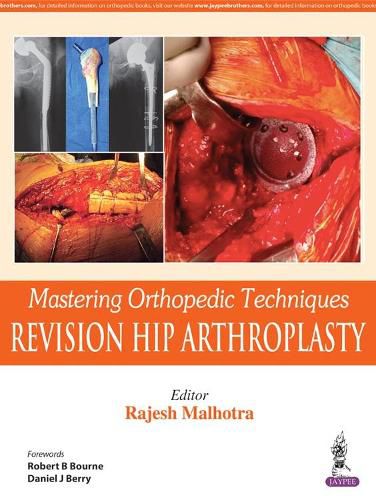 Cover image for Mastering Orthopedic Techniques: Revision Total Hip Arthroplasty