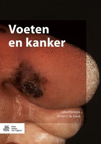 Voeten En Kanker