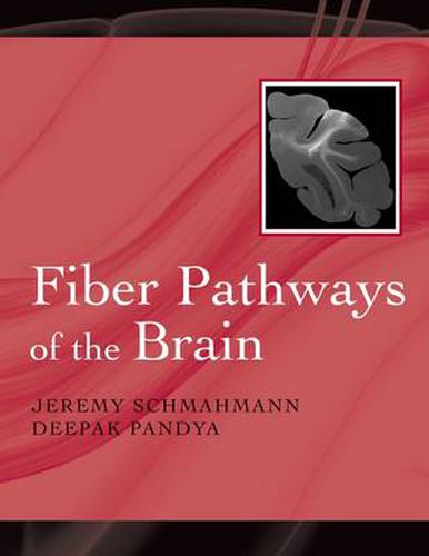 Cover image for Fiber Pathways of the Brain