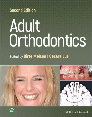 Cover image for Adult Orthodontics 2nd Edition