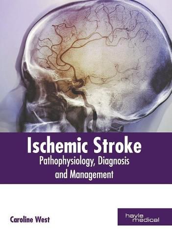 Cover image for Ischemic Stroke: Pathophysiology, Diagnosis and Management