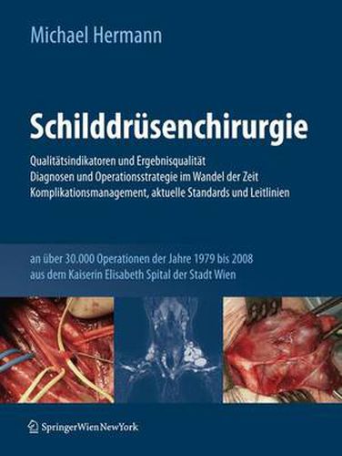 Cover image for Schilddrusenchirurgie - Qualitatsindikatoren Und Ergebnisqualitat, Diagnosen Und Operationsstrategie Im Wandel Der Zeit, Komplikationsmanagement, Aktuelle Standards Und Leitlinien