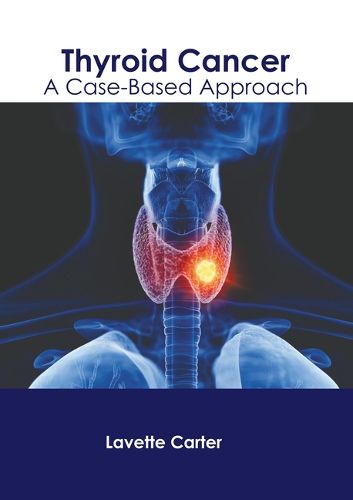 Cover image for Thyroid Cancer: A Case-Based Approach