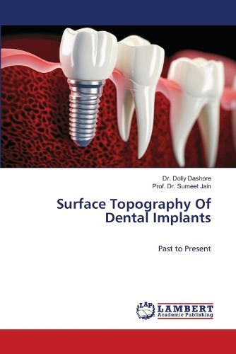 Cover image for Surface Topography Of Dental Implants