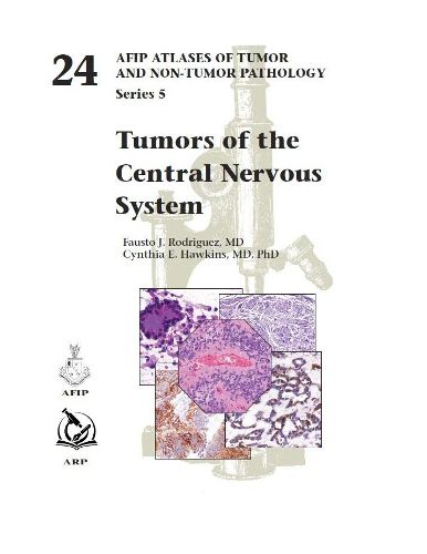 Cover image for Tumors of the Central Nervous System