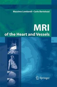 Cover image for MRI of the Heart and Vessels