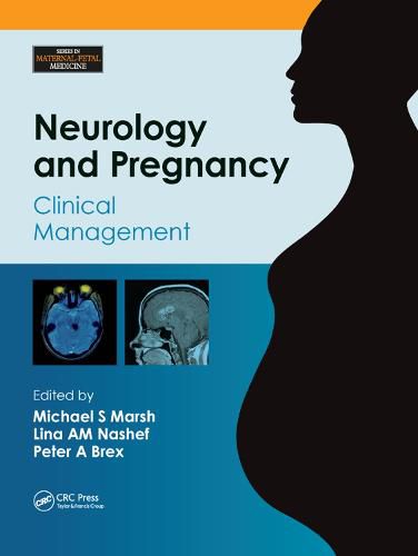 Neurology and Pregnancy: Clinical Management