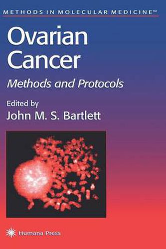 Cover image for Ovarian Cancer: Methods and Protocols