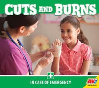 Cover image for Cuts and Burns