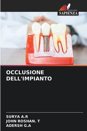 Cover image for Occlusione Dell'impianto
