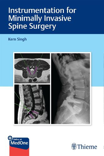 Cover image for Instrumentation for Minimally Invasive Spine Surgery