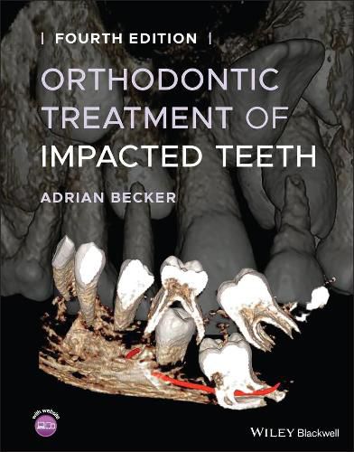 Cover image for Orthodontic Treatment of Impacted Teeth