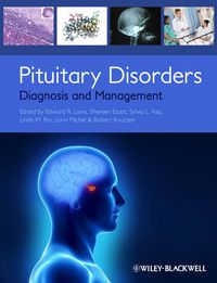 Cover image for Pituitary Disorders: Diagnosis and Management