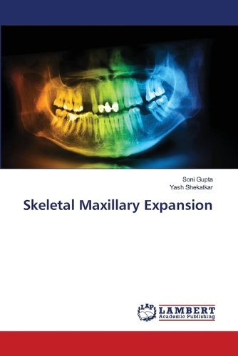 Cover image for Skeletal Maxillary Expansion
