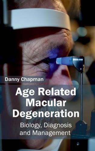 Cover image for Age Related Macular Degeneration: Biology, Diagnosis and Management