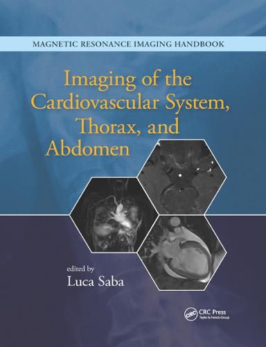 Cover image for Imaging of the Cardiovascular System, Thorax, and Abdomen