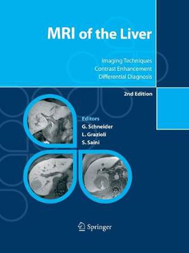 MRI of the Liver: Imaging Techniques, Contrast Enhancement, Differential Diagnosis