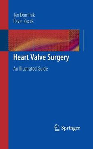 Cover image for Heart Valve Surgery: An Illustrated Guide