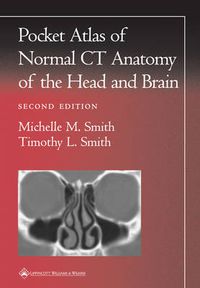 Cover image for Pocket Atlas of Normal CT Anatomy of the Head and Brain