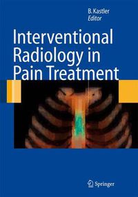 Cover image for Interventional Radiology in Pain Treatment