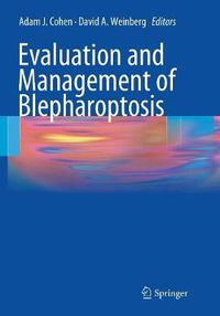 Cover image for Evaluation and Management of Blepharoptosis