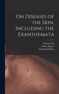 Cover image for On Diseases of the Skin, Including the Exanthemata