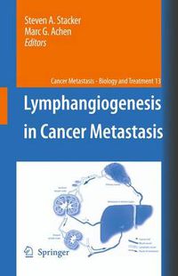 Cover image for Lymphangiogenesis in Cancer Metastasis