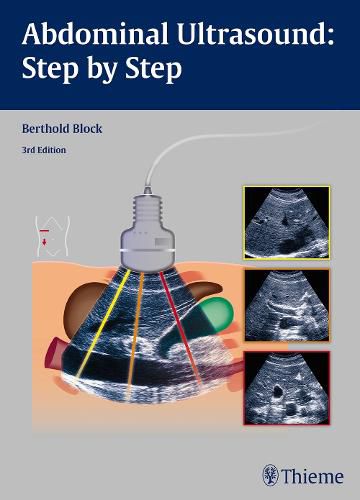 Cover image for Abdominal Ultrasound: Step by Step