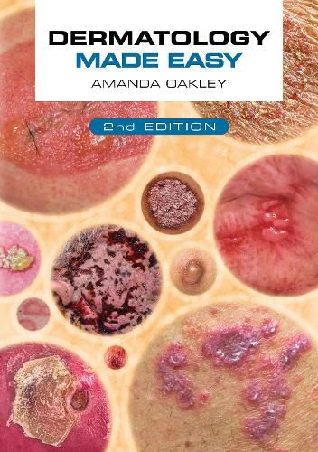 Cover image for Dermatology Made Easy, second edition