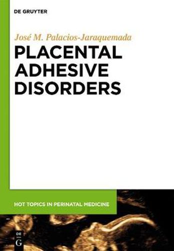 Placental Adhesive Disorders