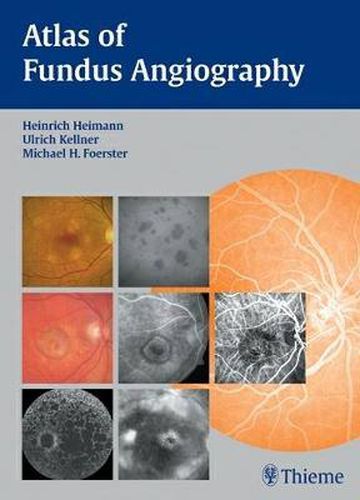 Cover image for Atlas of Fundus Angiography