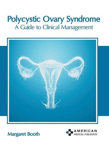 Cover image for Polycystic Ovary Syndrome: A Guide to Clinical Management