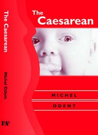 Cover image for The Caesarean