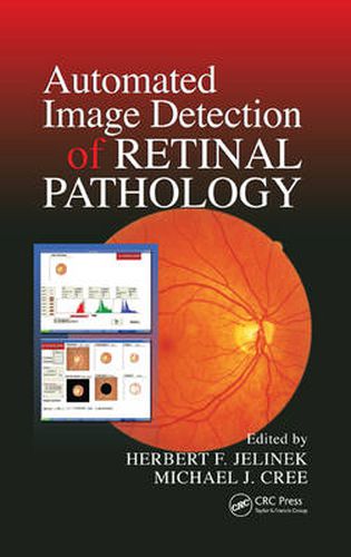 Cover image for Automated Image Detection of Retinal Pathology