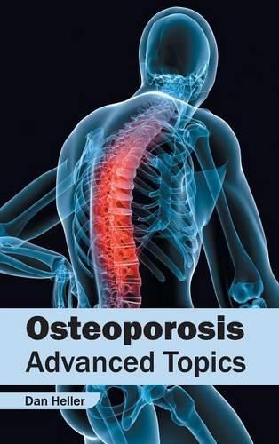 Cover image for Osteoporosis: Advanced Topics