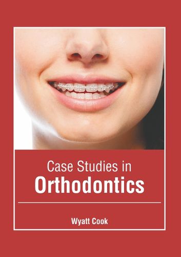 Cover image for Case Studies in Orthodontics