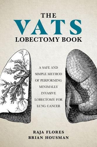 Cover image for The VATS Lobectomy Book