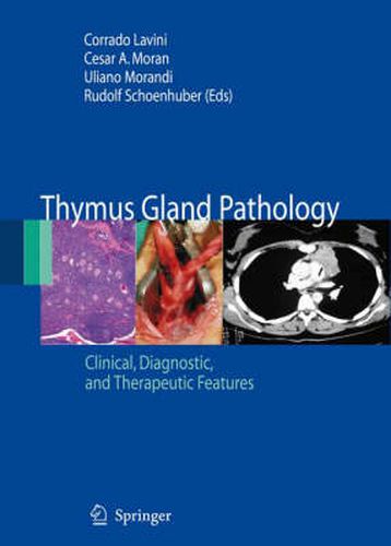 Cover image for Thymus Gland Pathology: Clinical, Diagnostic and Therapeutic Features