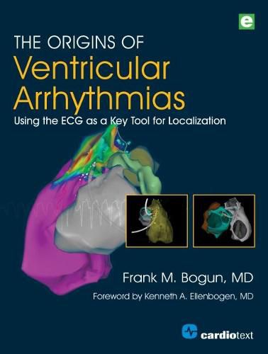 The Origins of Ventricular Arrhythmias: Using the ECG as a Key Tool for Localization