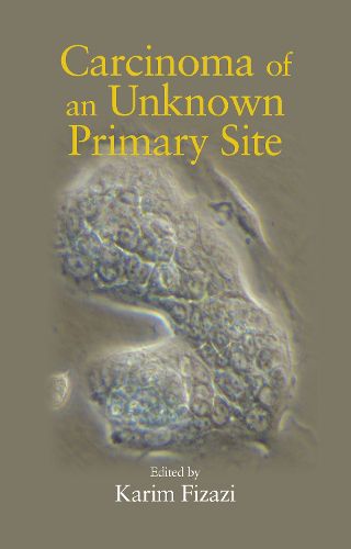 Cover image for Carcinoma of an Unknown Primary Site