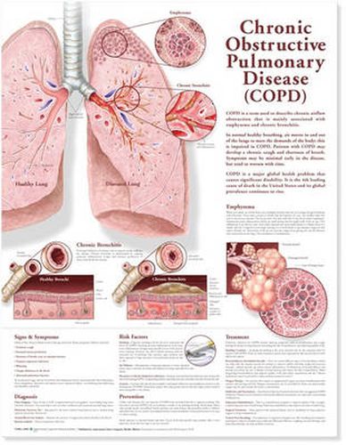 Cover image for Chronic Obstructive Pulmonary Disease Anatomical Chart