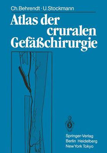 Cover image for Atlas Der Cruralen Gefasschirurgie