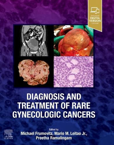 Cover image for Diagnosis and Treatment of Rare Gynecologic Cancers