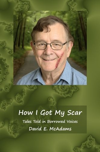 Cover image for How I Got My Scar