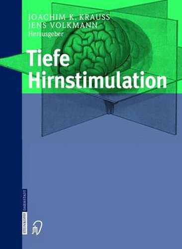 Cover image for Tiefe Hirnstimulation