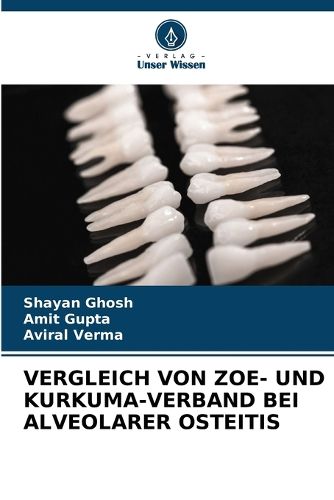 Cover image for Vergleich Von Zoe- Und Kurkuma-Verband Bei Alveolarer Osteitis