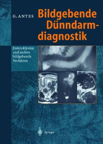 Cover image for Bildgebende Dunndarmdiagnostik: Enteroklysma und andere bildgebende Verfahren