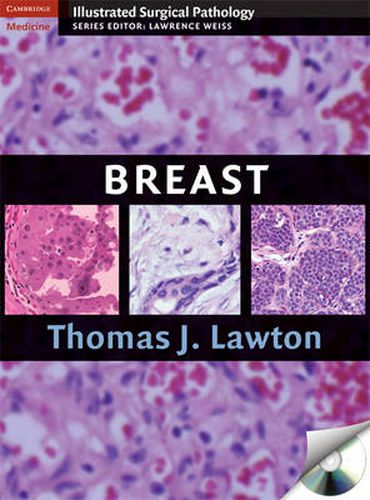 Cover image for Breast