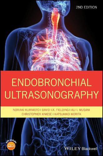 Cover image for Endobronchial Ultrasonography 2e